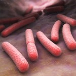 What Causes Heartburn and GERD?
