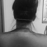 Need Chiropractic Care? Check Your Posture